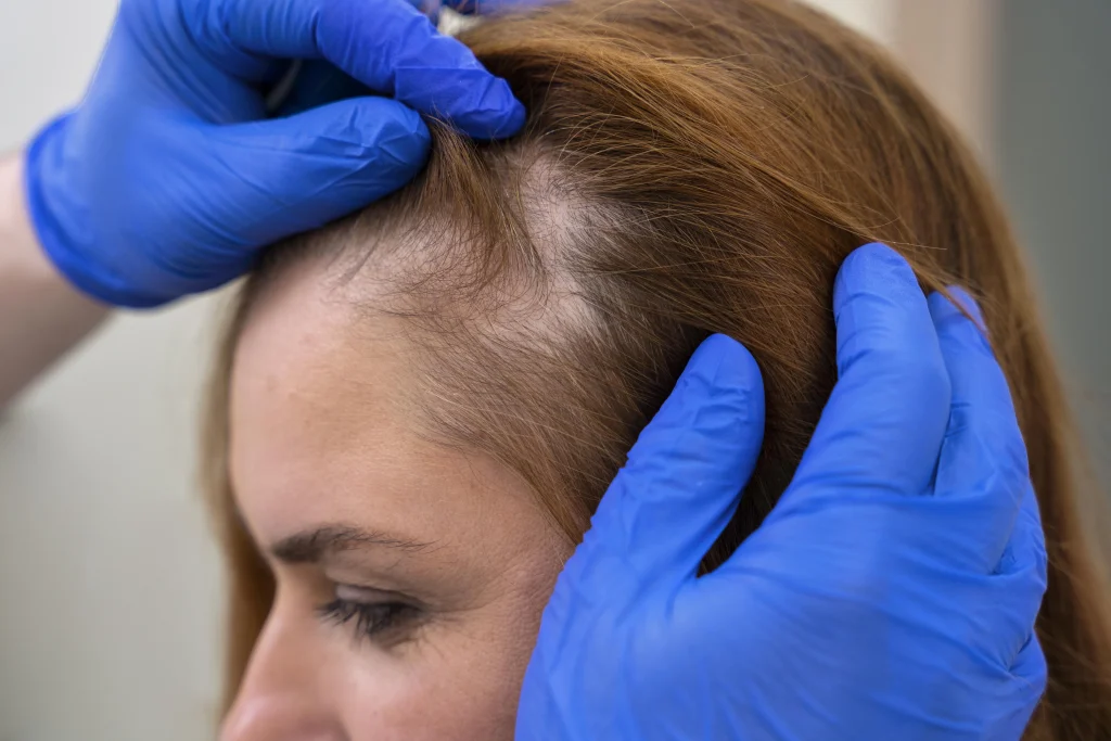 Doctora valorando la caída del cabello de una paciente en consulta